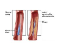 USA Vascular Centers image 1